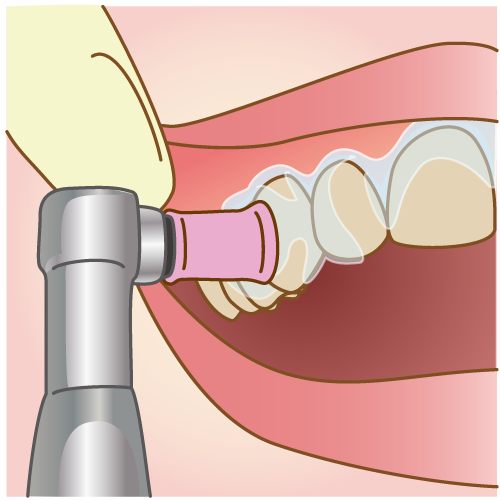 歯の表面を磨いていきます