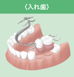 入れ歯
